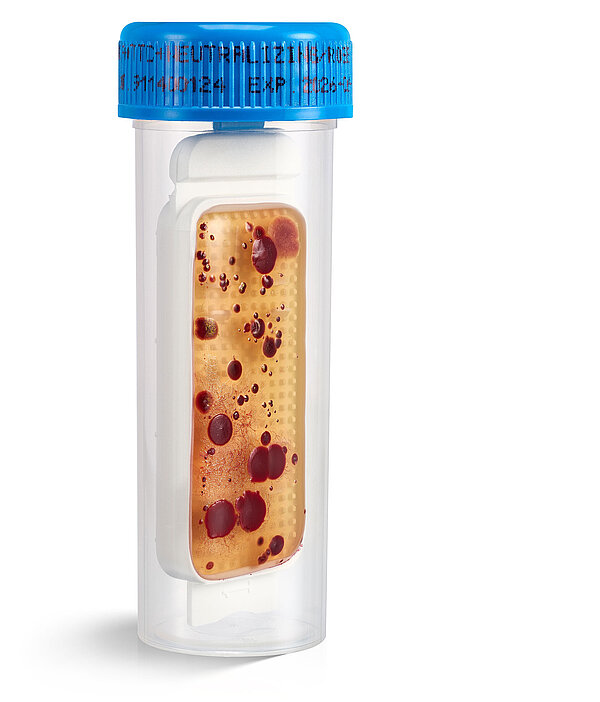 Eine Petrischale, in der eine Kultur wächst